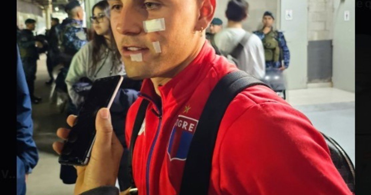 Cómo le quedó la cara a Nacho Russo tras los cortes sufridos en Tigre vs. San Lorenzo por Copa Argentina :: Olé