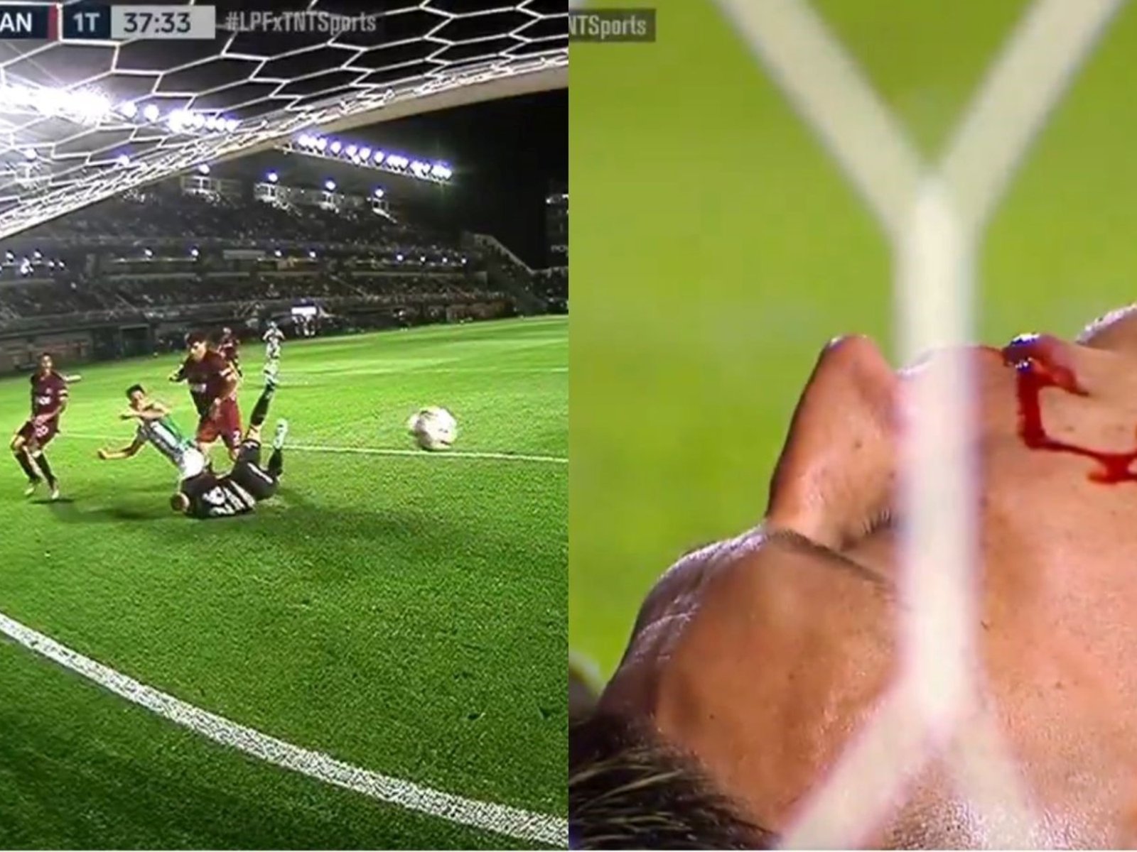 el impactante corte en el rostro del arquero Losada en el gol de Banfield