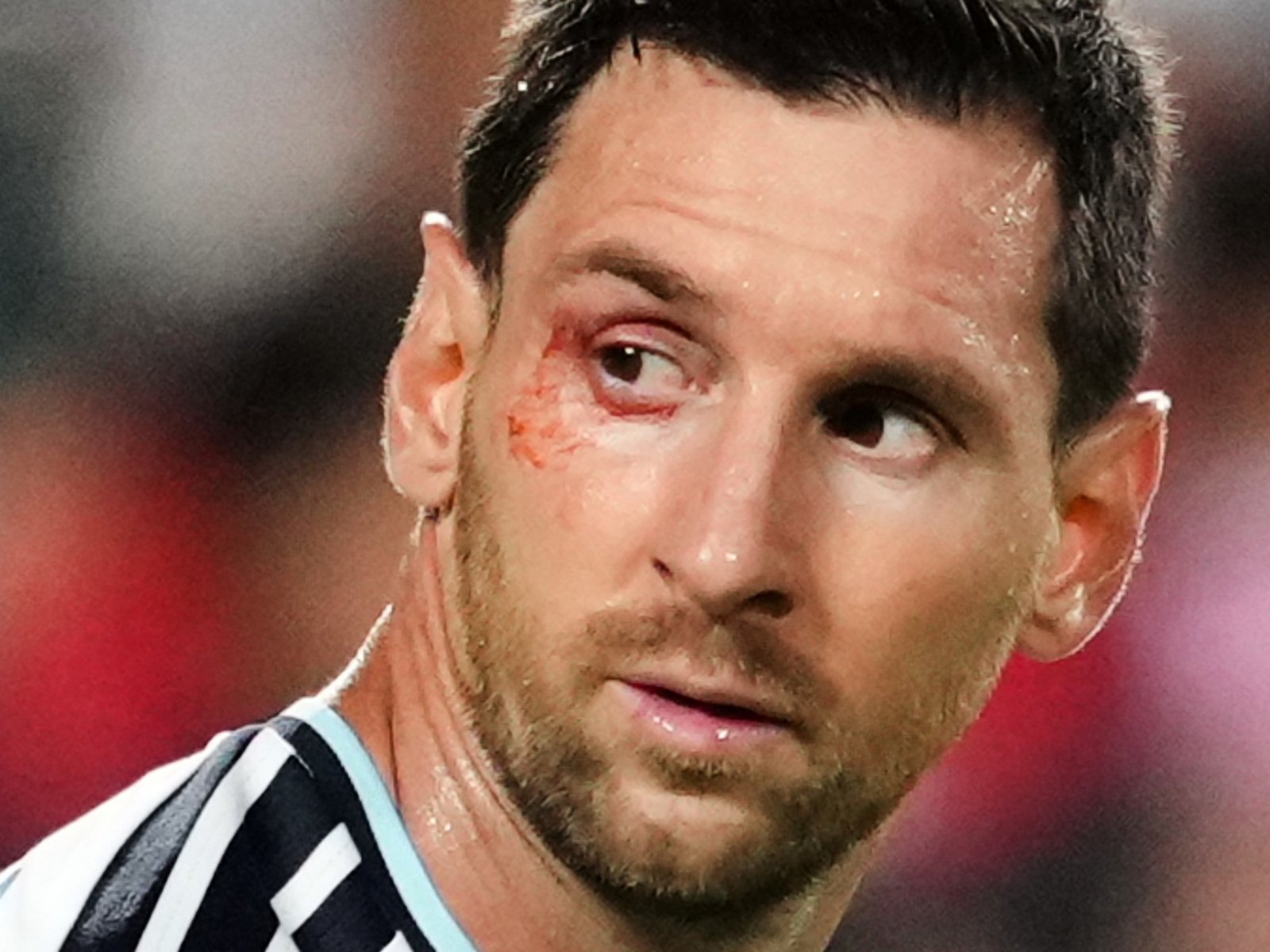 Messi y un sorprendente sangrado en su ojo durante el Argentina-Suiza :: Olé