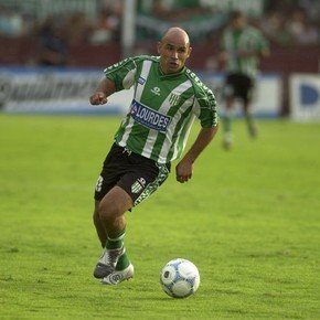 Día Mundial del Pelado: los calvos más icónicos del Ascenso argentino